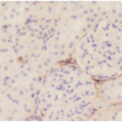 Pyruvate Dehydrogenase Kinase Isozyme 4 (PDK4) Antibody