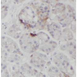 PDLIM1 / CLP36 Antibody