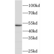 WB analysis of mouse lung tissue, using PDLIM1,CLP36 antibody (1/600 dilution).