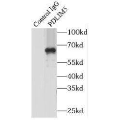 PDZ And LIM Domain 5 (PDLIM5) Antibody