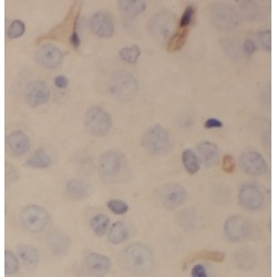 Pyruvate Dehyrogenase Phosphatase Catalytic Subunit 2 (PDP2) Antibody