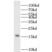 WB analysis of Jurkat cells, using PDRG1 antibody (1/1000 dilution).