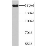 WB analysis of HT-1080 cells, using PDS5B antibody (1/400 dilution).
