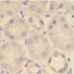 Pyridoxal Dependent Decarboxylase Domain Containing 1 (PDXDC1) Antibody