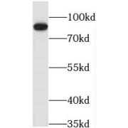 WB analysis of HeLa cells, using PDXDC1 antibody (1/500 dilution).