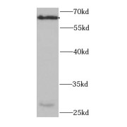 WB analysis of mouse liver tissue, using PDZK1 antibody (1/1000 dilution).