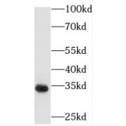 WB analysis of human kidney tissue, using PECR antibody (1/400 dilution).