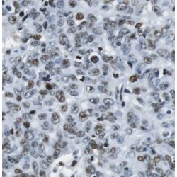 Retrotransposon-Derived Protein PEG10 (PEG10) Antibody