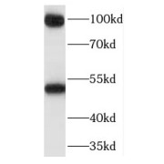 WB analysis of MCF7 cells, using PEG10 antibody (1/500 dilution).