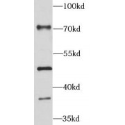 WB analysis of HepG2 cells, using Pentraxin 3 antibody (1/300 dilution).
