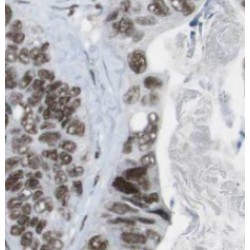 Pepsinogen C (PGC) Antibody