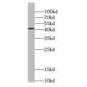 WB analysis of human stomach tissue, using Pepsinogen II antibody (1/800 dilution).