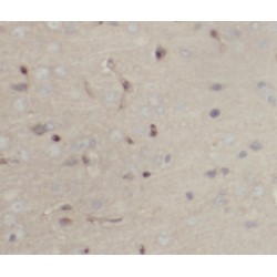 Peripherin (PRPH) Antibody