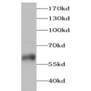 WB analysis of COLO 320 cells, using PRPH antibody (1/1000 dilution).