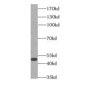 WB analysis of HeLa cells, using PERLD1 antibody (1/300 dilution).