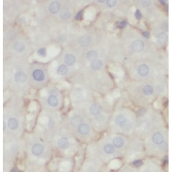 peroxiredoxin 2 (PRDX2) Antibody