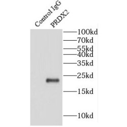 peroxiredoxin 2 (PRDX2) Antibody