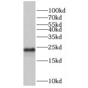 WB analysis of HeLa cells, using PRDX2 antibody (1/500 dilution).