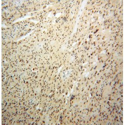 Pescadillo Ribosomal Biogenesis Factor 1 (PES1) Antibody