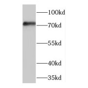 WB analysis of human kidney tissue, using PES1 antibody (1/400 dilution).