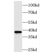 WB analysis of human liver tissue, using PEX16 antibody (1/500 dilution).