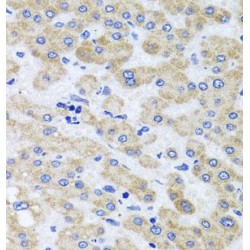 Peroxisomal Biogenesis Factor 3 (PEX3) Antibody