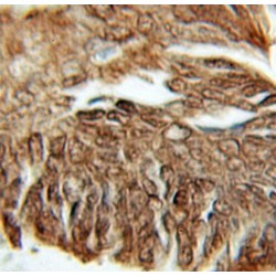 Prefoldin Subunit 1 (PFDN1) Antibody