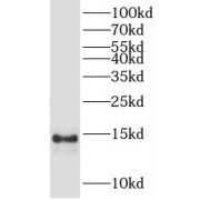 WB analysis of human brain tissue, using PFDN1 antibody (1/800 dilution).