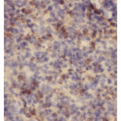 6-Phosphofructo-2-Kinase/Fructose-2,6-Biphosphatase 2 (PFKFB2) Antibody