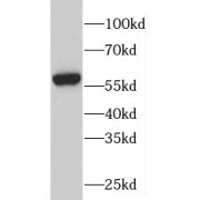 WB analysis of human heart tissue, using PFKFB2 antibody (1/500 dilution).