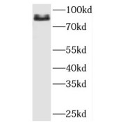 WB analysis of mouse heart tissue, using PFKP antibody (1/1500 dilution).