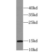 WB analysis of mouse brain tissue, using PFN2 antibody (1/2000 dilution).