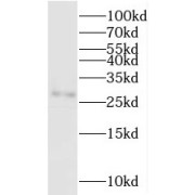 WB analysis of mouse testis tissue, using PGAM2 antibody (1/600 dilution).