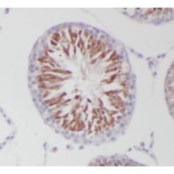 Post-GPI Attachment To Proteins 1 (PGAP1) Antibody