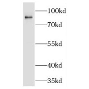 WB analysis of HeLa cells, using PGBD1 antibody (1/600 dilution).