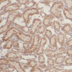 PiggyBac Transposable Element Derived 3 (PGBD3) Antibody