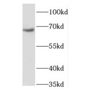 WB analysis of HeLa cells, using PGBD3 antibody (1/500 dilution).