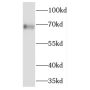 WB analysis of L02 cells, using PGCP antibody (1/600 dilution).