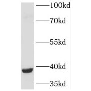 WB analysis of Apoptosised HeLa cells, using PGLYRP3 antibody (1/500 dilution).