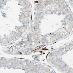 Phosphoglucomutase-1 (PGM1) Antibody