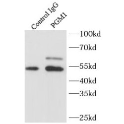 Phosphoglucomutase-1 (PGM1) Antibody