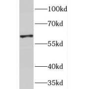 WB analysis of mouse heart tissue, using PGM1 antibody (1/1000 dilution).