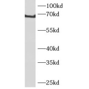 WB analysis of human brain tissue, using PGM2 antibody (1/200 dilution).