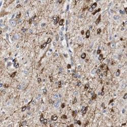 hosphoglucomutase 2 Like 1 (PGM2L1) Antibody