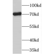 WB analysis of mouse skeletal muscle tissue, using PGM2L1 antibody (1/800 dilution).