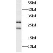 WB analysis of HeLa cells, using PGRMC2 antibody (1/1000 dilution).