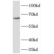 WB analysis of NIH/3T3 cells, using PGT antibody (1/1000 dilution).