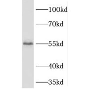 WB analysis of HeLa cells, using PHAX antibody (1/800 dilution).