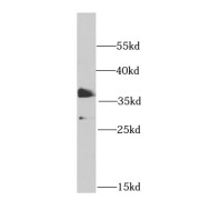 WB analysis of HeLa cells, using PHF11 antibody (1/1000 dilution).