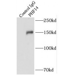 PHD Finger Protein 14 (PHF14) Antibody